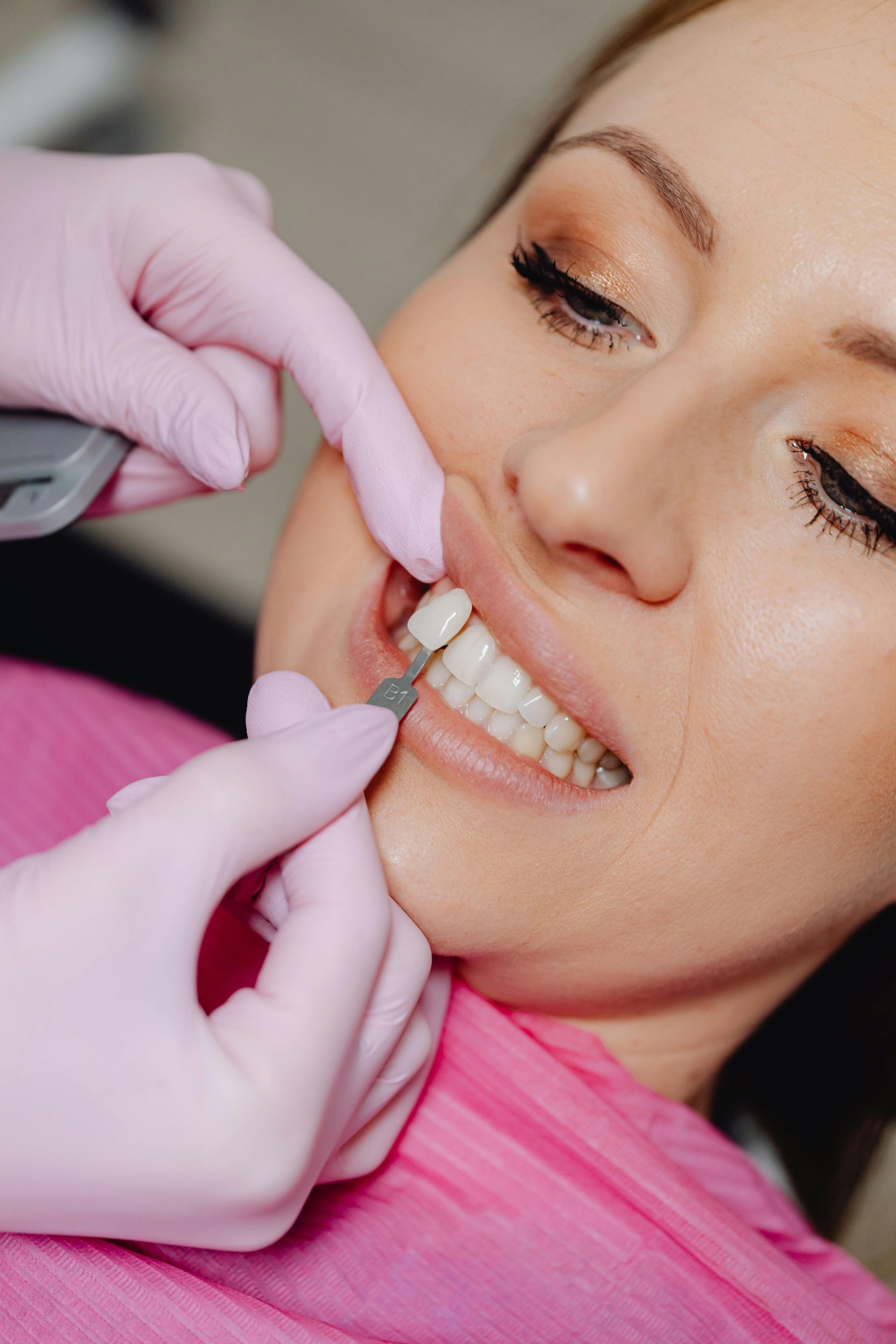 DENTAL Veneers Sydney