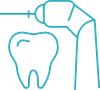 A line drawing of a tooth being drilled with a drill.