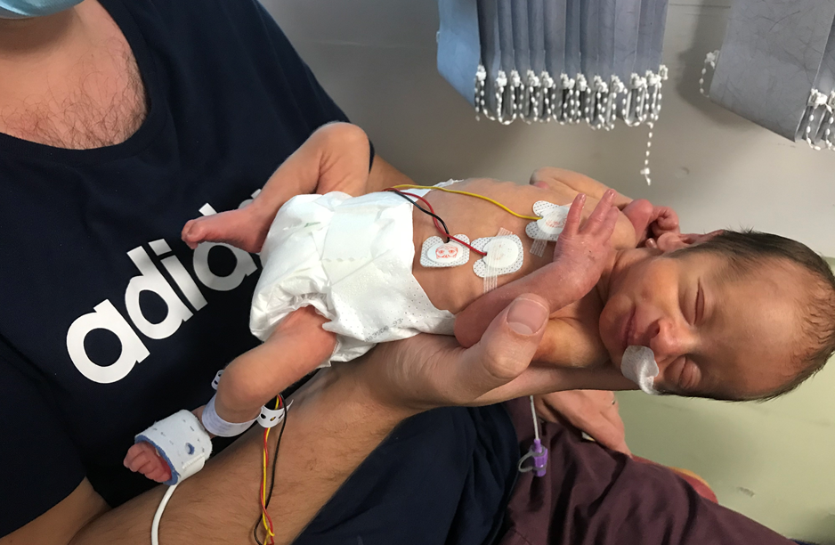 Premature baby 32 weeks born
