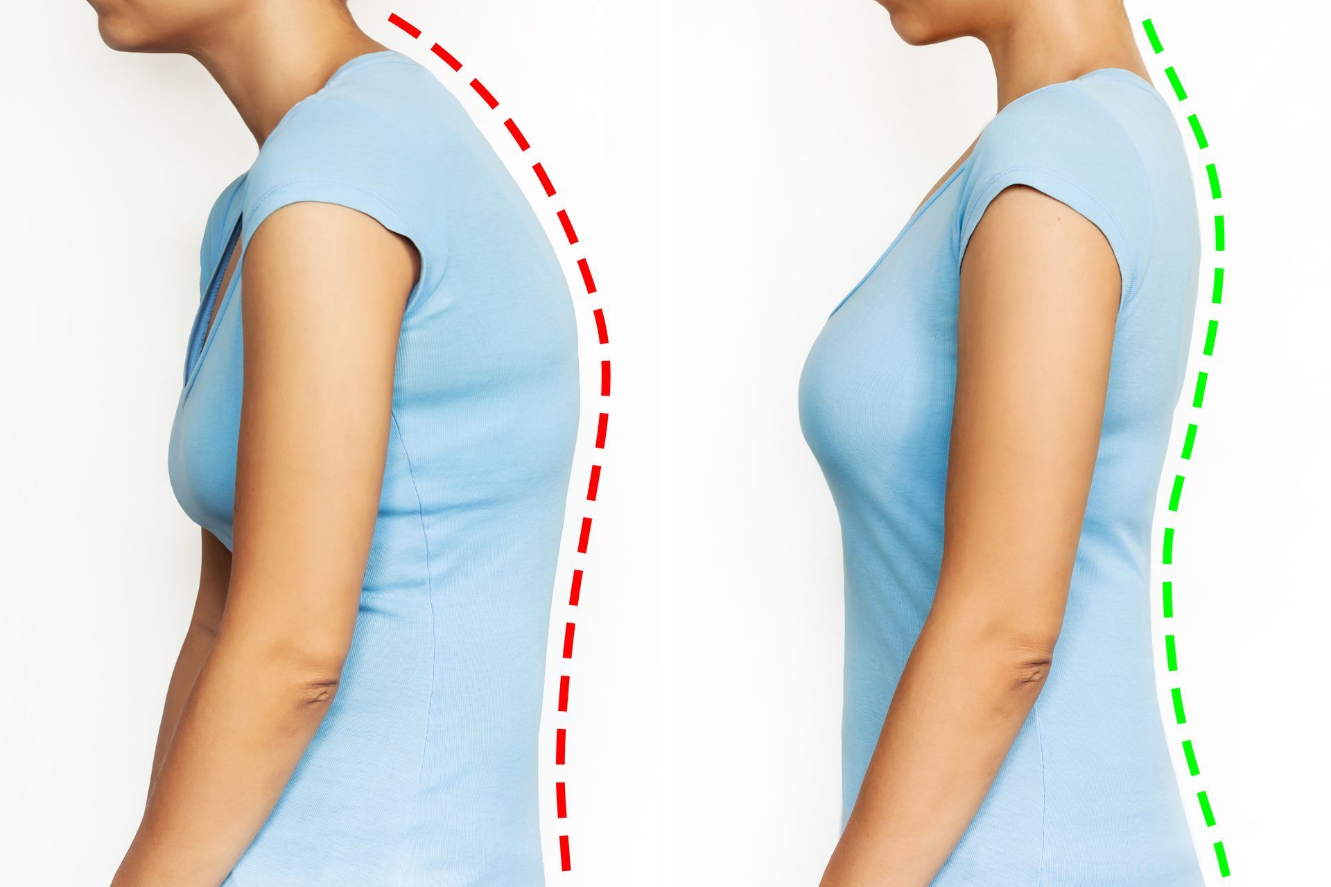 Side-by-side comparison of a person showing poor posture with a red dashed line versus good posture with a green dashed line.