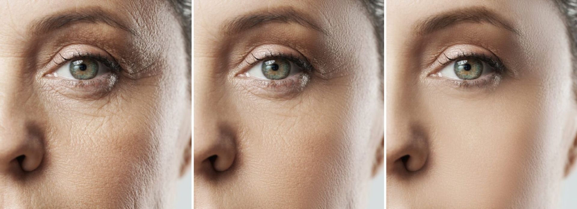 Laser Skin Rejuvenation from Williamson Cosmetic Center - Gonzales, La