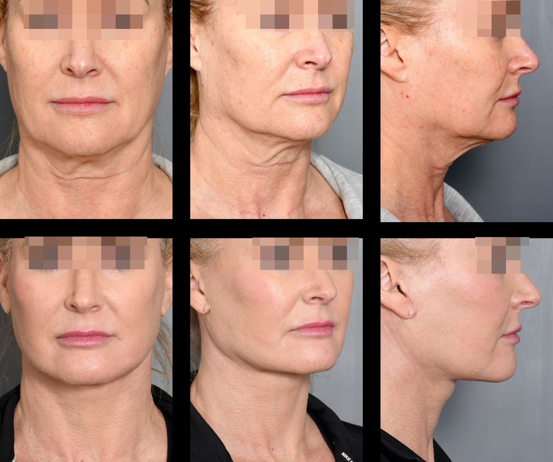 Dr. Jon Perenack - Williamson Cosmetic Center & Perenack Aesthetic Surgery