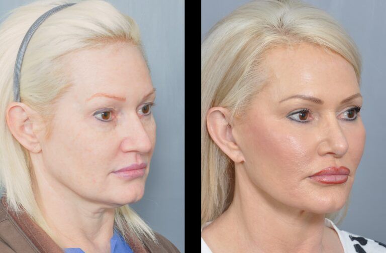 Dr. Jon Perenack - Williamson Cosmetic Center & Perenack Aesthetic Surgery