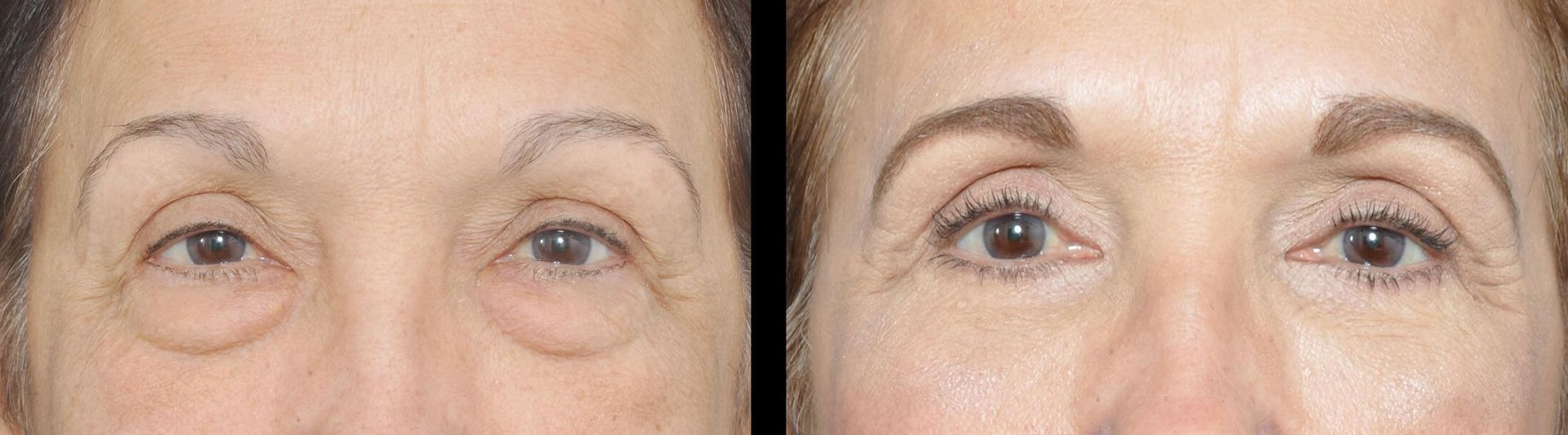 Before and after eye close-up.  The “after” has darker, defined eyebrows.