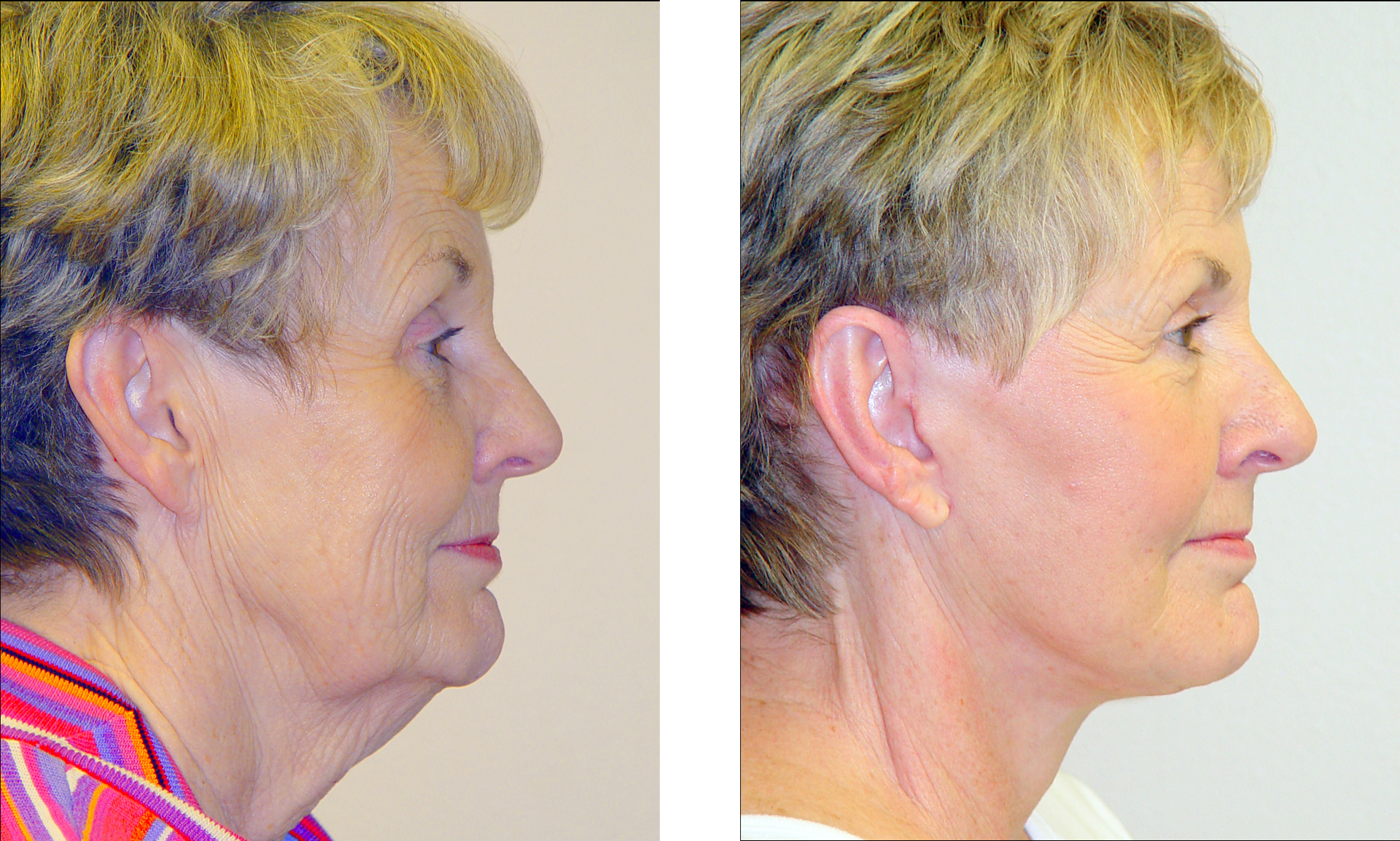 Dr. Jon Perenack - Williamson Cosmetic Center & Perenack Aesthetic Surgery