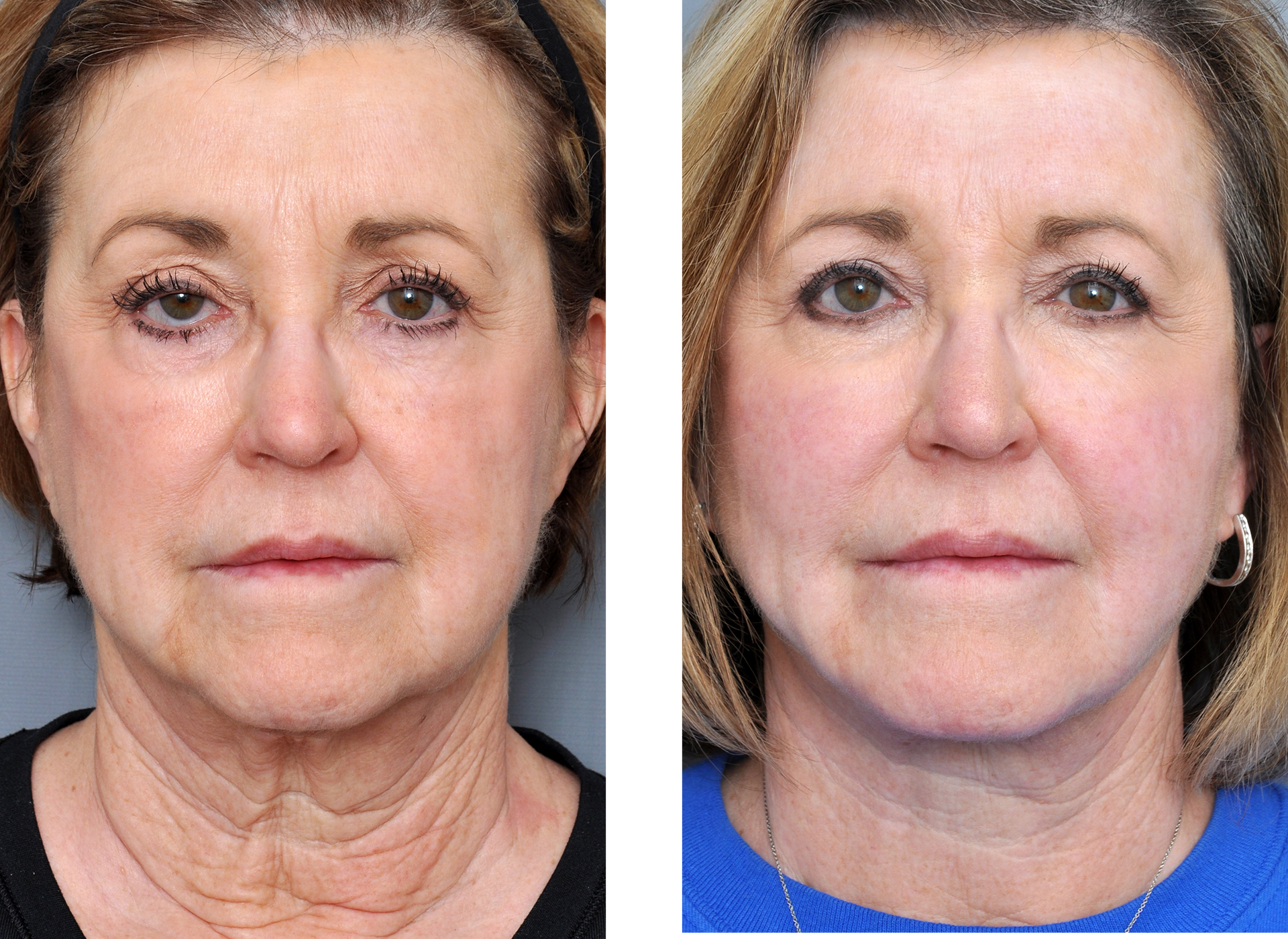 Dr. Jon Perenack - Williamson Cosmetic Center & Perenack Aesthetic Surgery