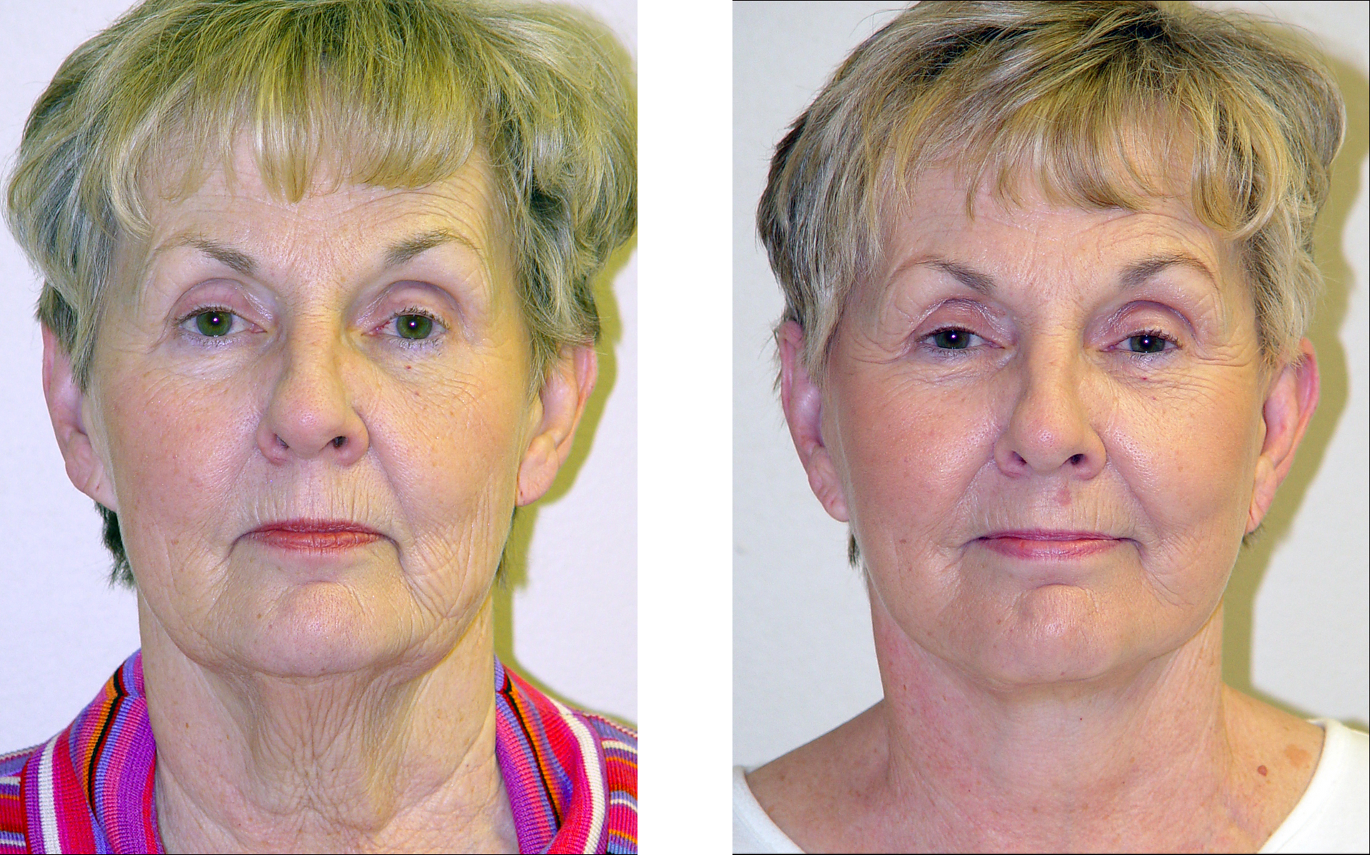 Dr. Jon Perenack - Williamson Cosmetic Center & Perenack Aesthetic Surgery