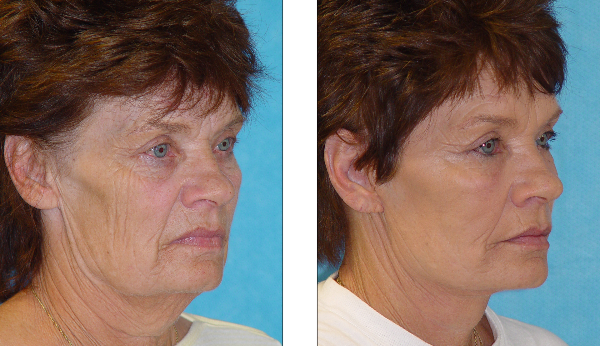 Dr. Jon Perenack - Williamson Cosmetic Center & Perenack Aesthetic Surgery