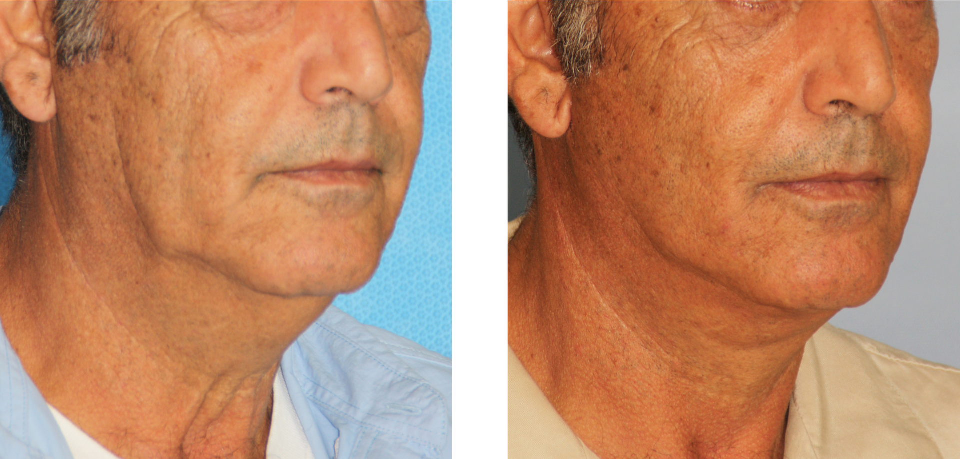 Dr. Jon Perenack - Williamson Cosmetic Center & Perenack Aesthetic Surgery