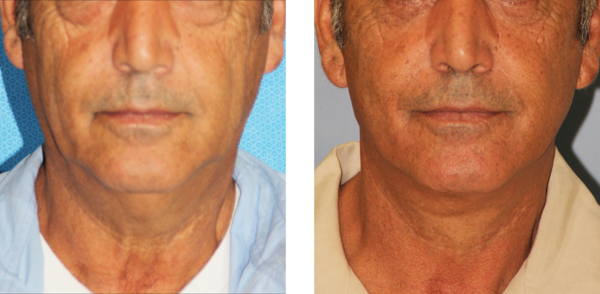 Dr. Jon Perenack - Williamson Cosmetic Center & Perenack Aesthetic Surgery