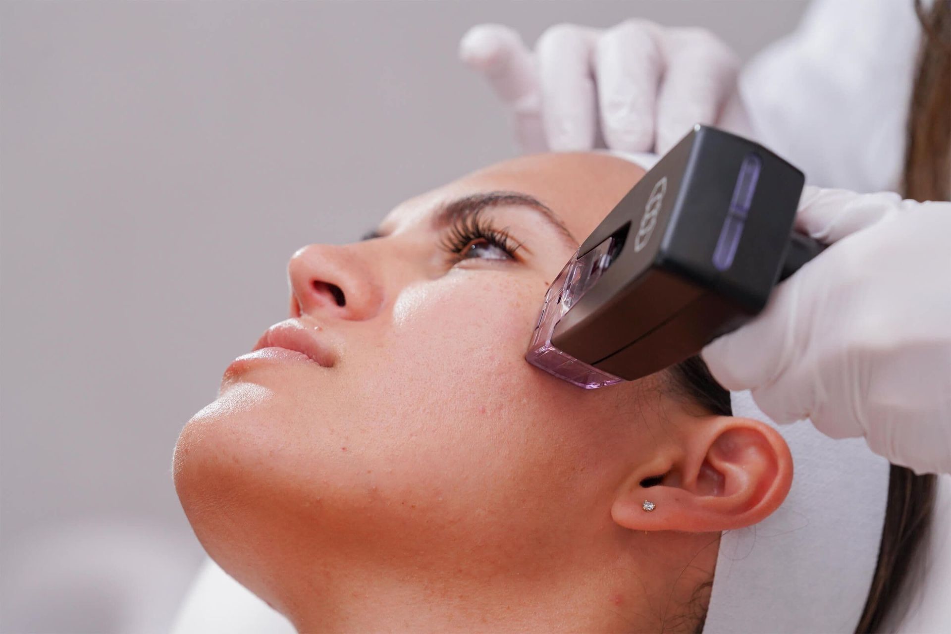 Morpheus8: Snatch, Tighten & Refresh Your Look This Fall from Williamson Cosmetic Center