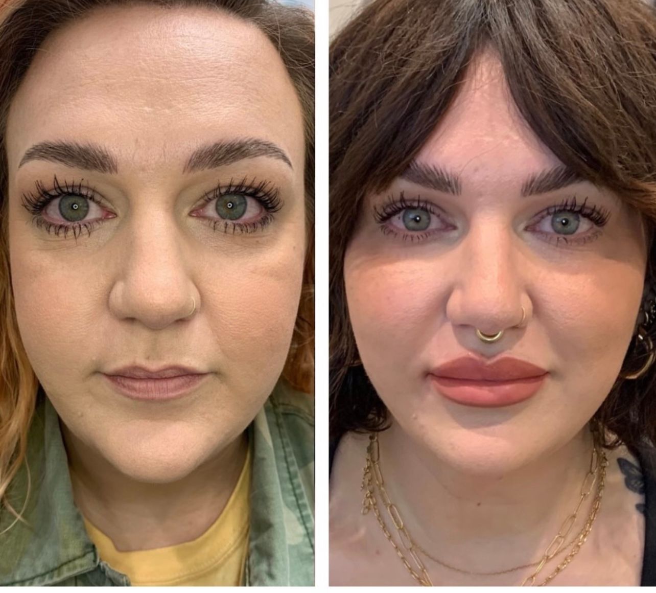 Side-by-side photos of a woman's face, showing before and after cosmetic enhancements.