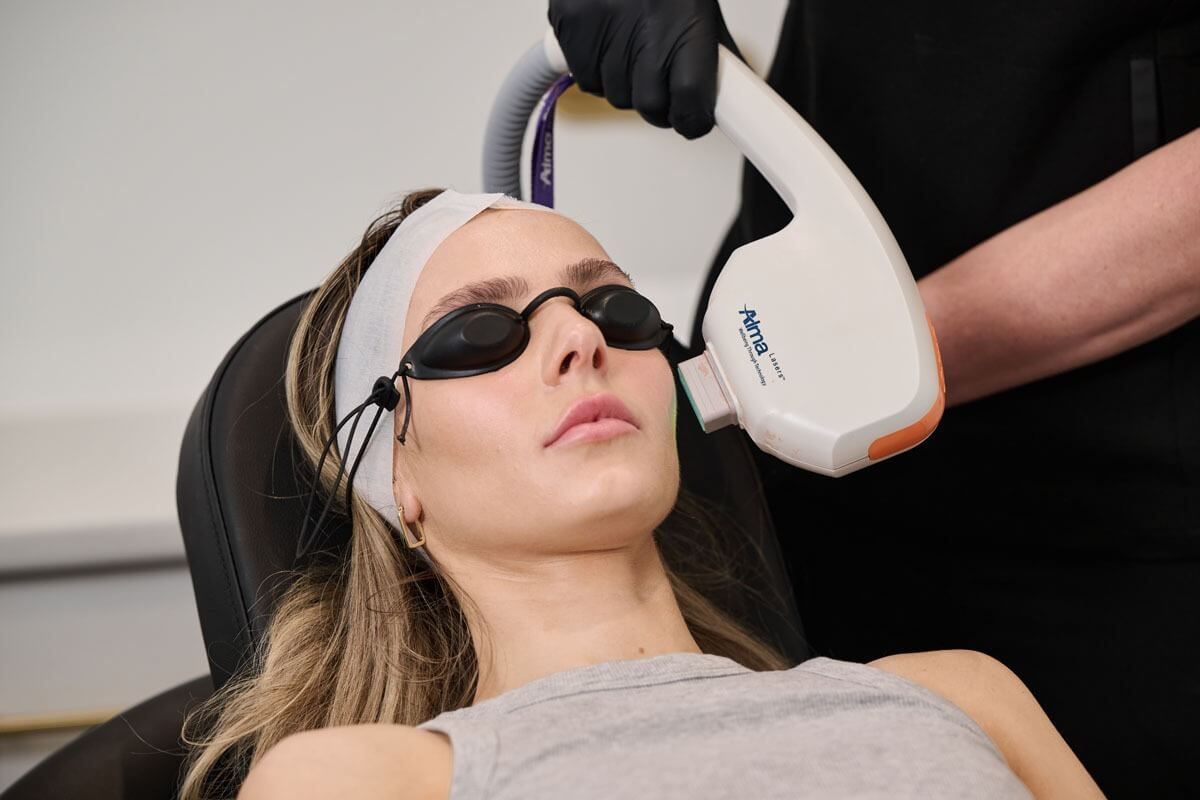 Woman receiving laser skin treatment on face, wearing protective eyewear and headband.