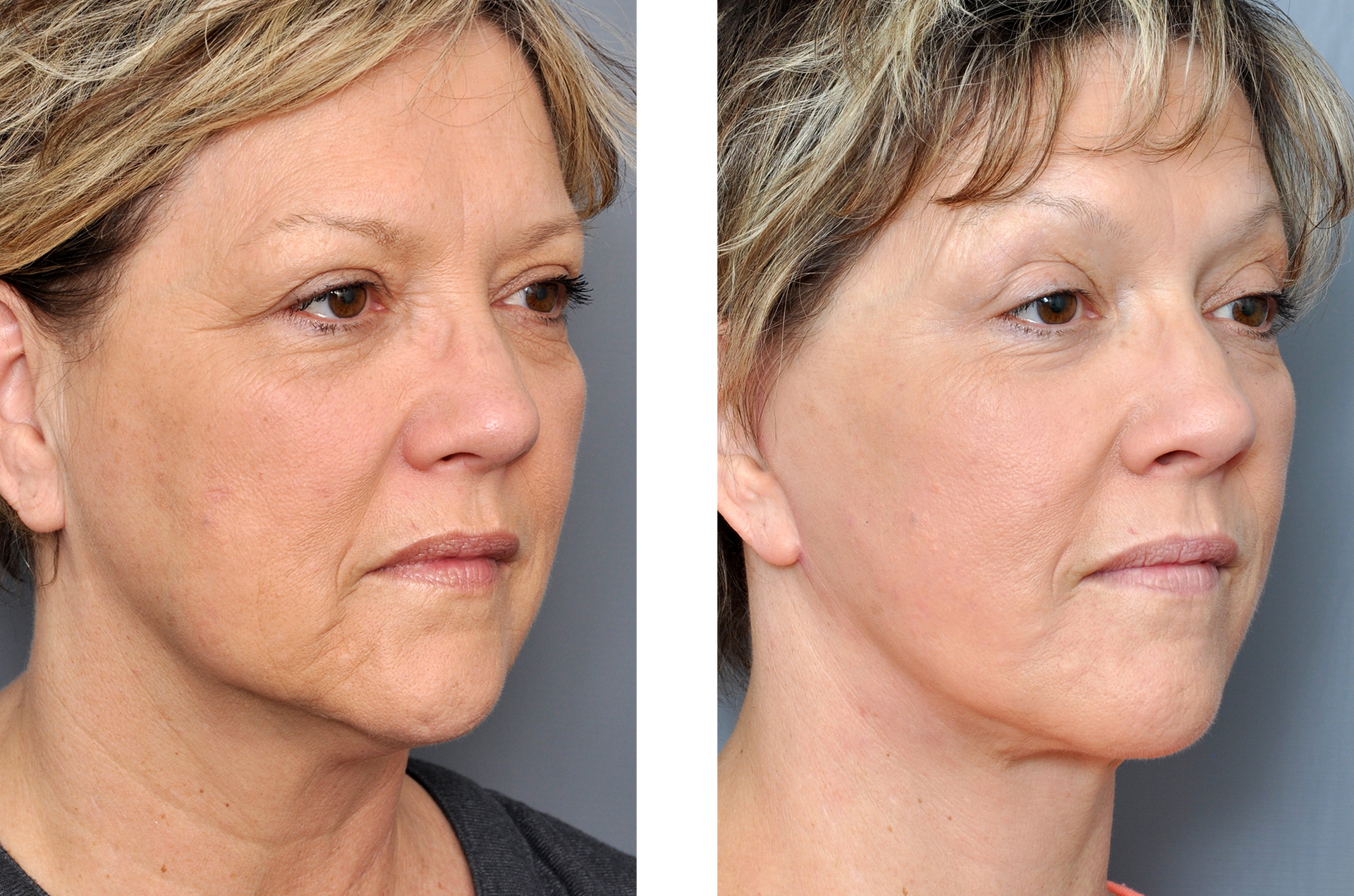 Dr. Jon Perenack - Williamson Cosmetic Center & Perenack Aesthetic Surgery