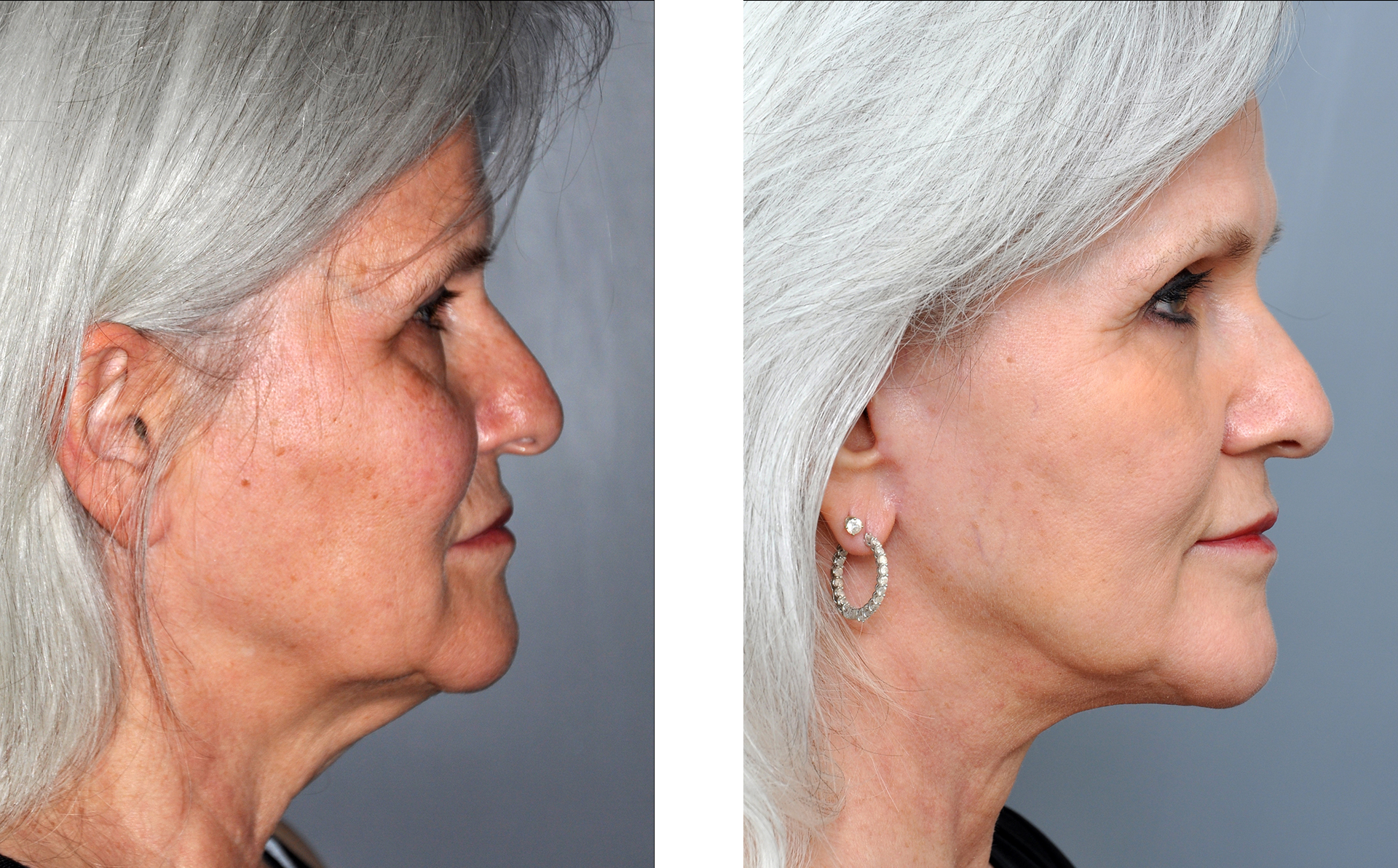 Dr. Jon Perenack - Williamson Cosmetic Center & Perenack Aesthetic Surgery