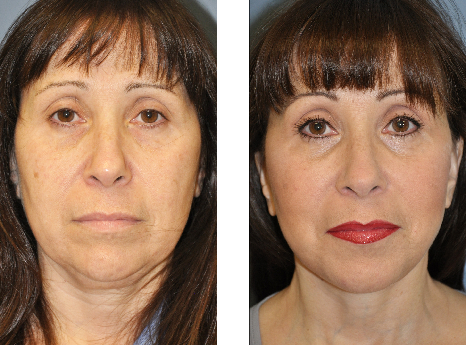 Dr. Jon Perenack - Williamson Cosmetic Center & Perenack Aesthetic Surgery