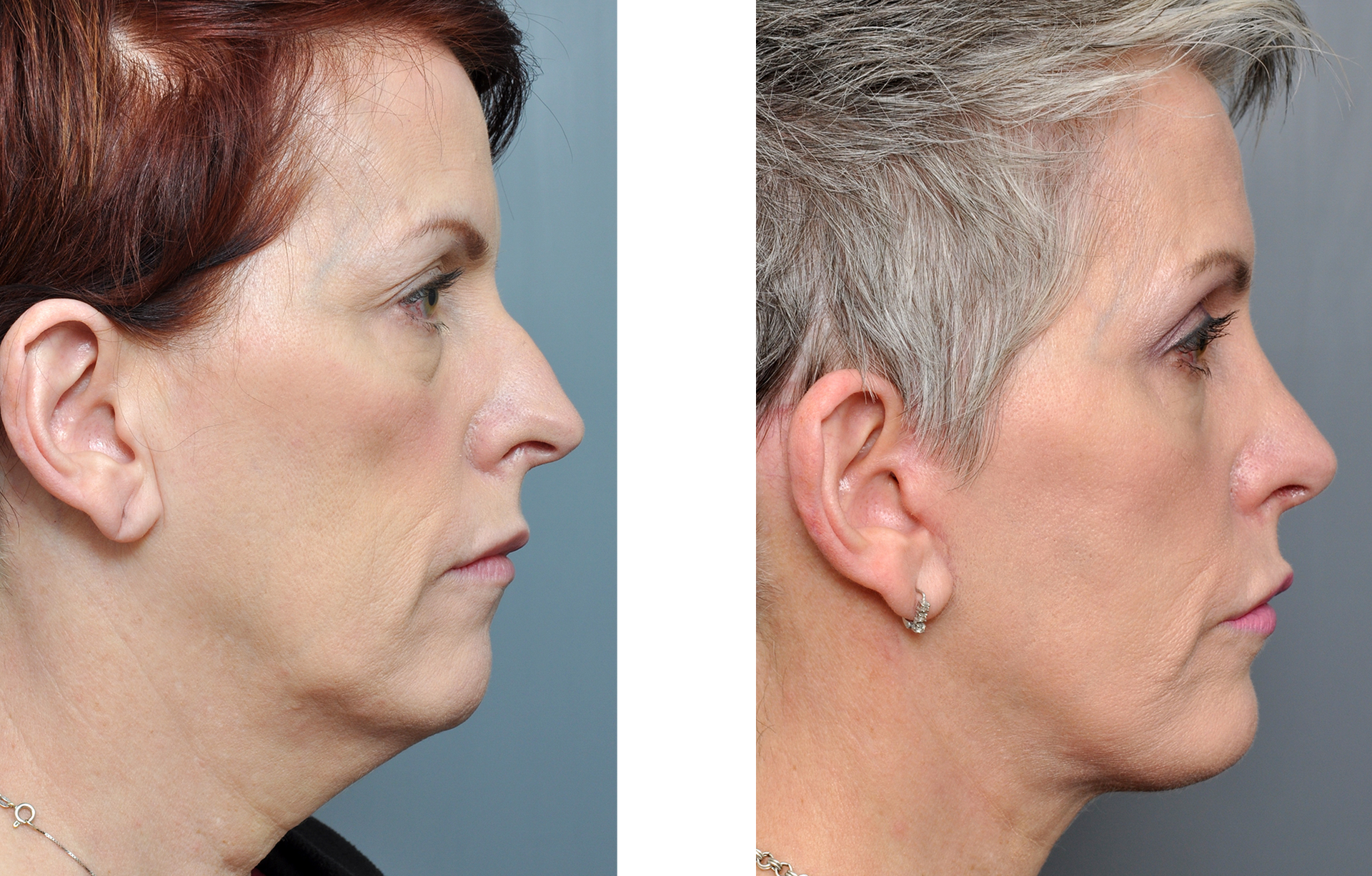 Dr. Jon Perenack - Williamson Cosmetic Center & Perenack Aesthetic Surgery