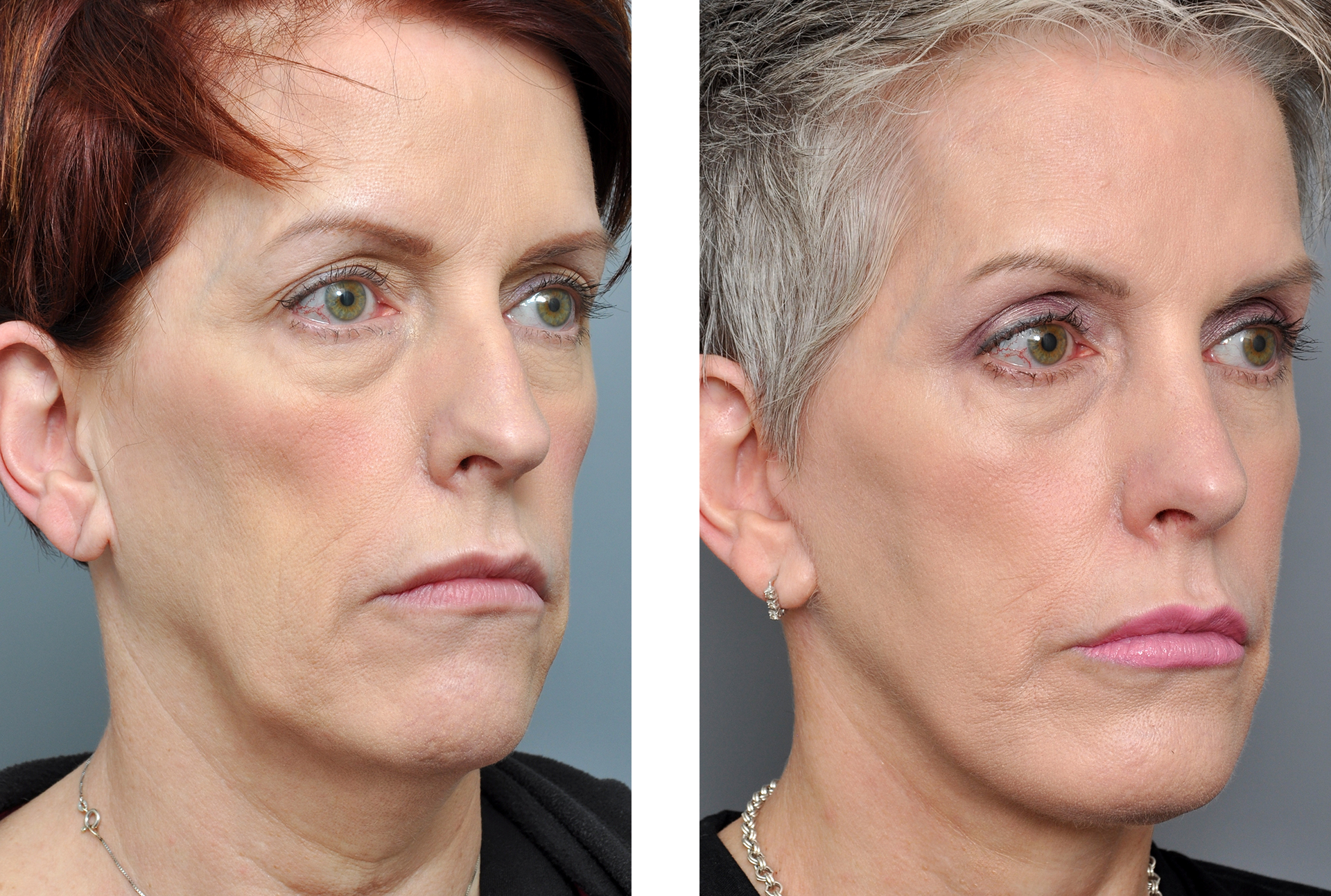 Dr. Jon Perenack - Williamson Cosmetic Center & Perenack Aesthetic Surgery