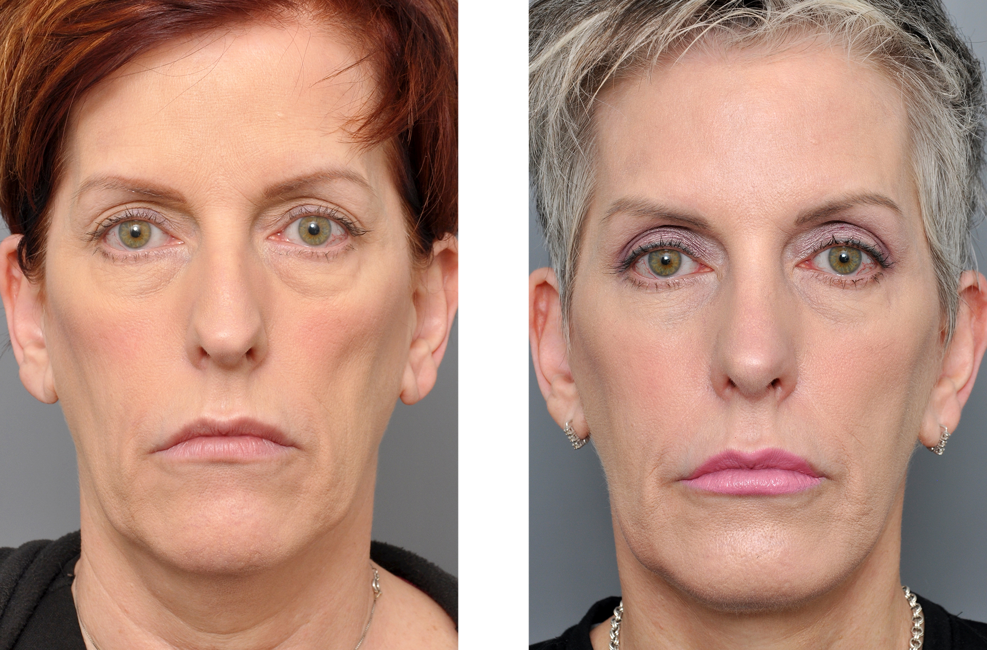 Dr. Jon Perenack - Williamson Cosmetic Center & Perenack Aesthetic Surgery