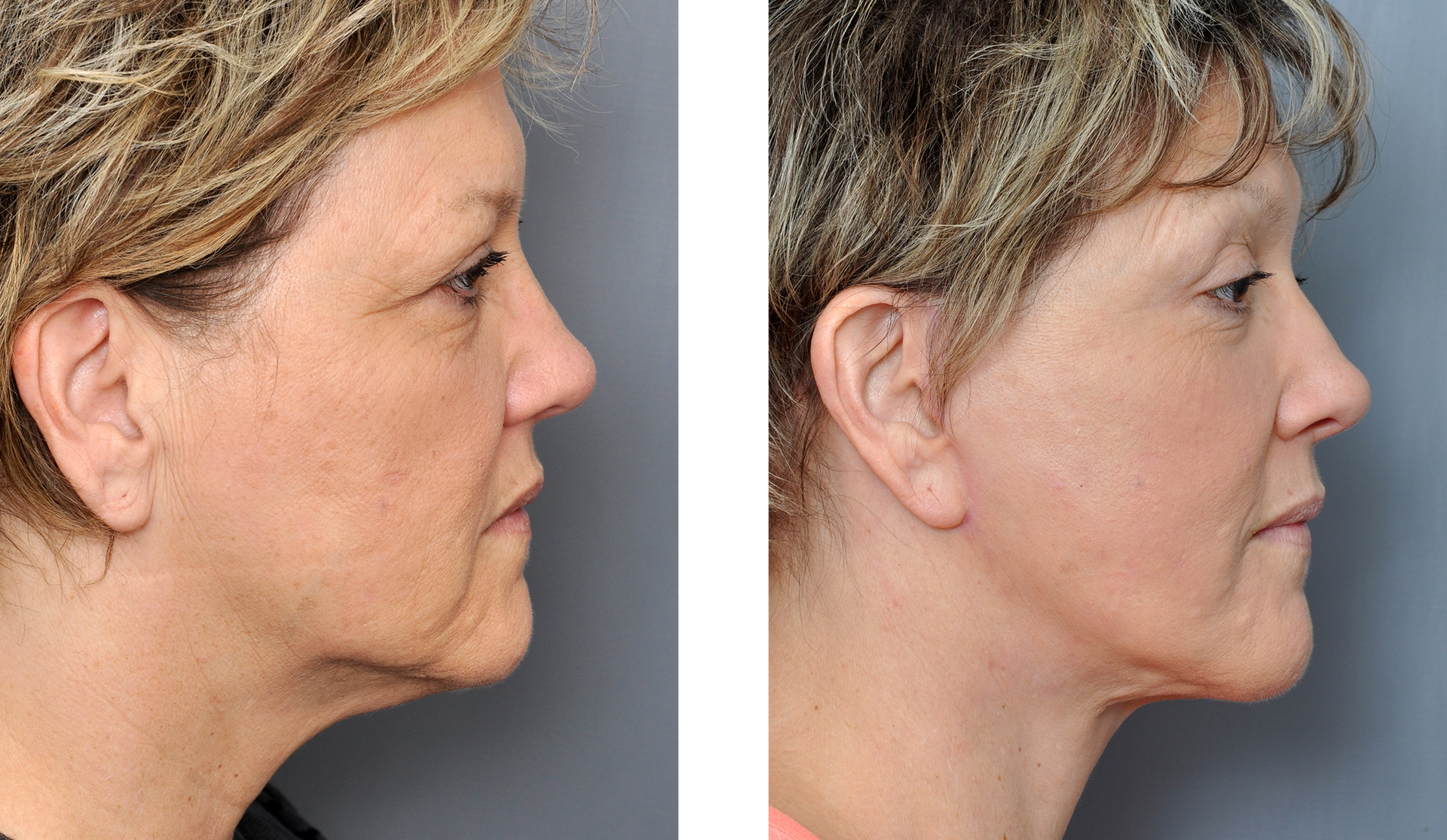 Dr. Jon Perenack - Williamson Cosmetic Center & Perenack Aesthetic Surgery