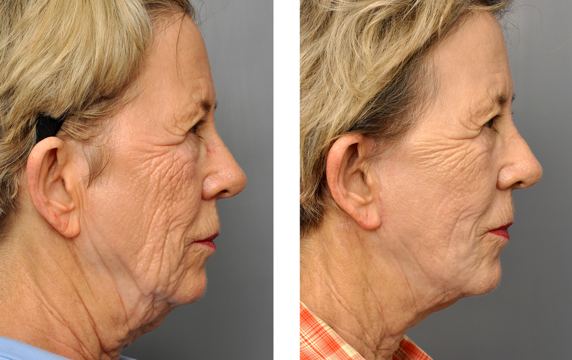 Dr. Jon Perenack - Williamson Cosmetic Center & Perenack Aesthetic Surgery