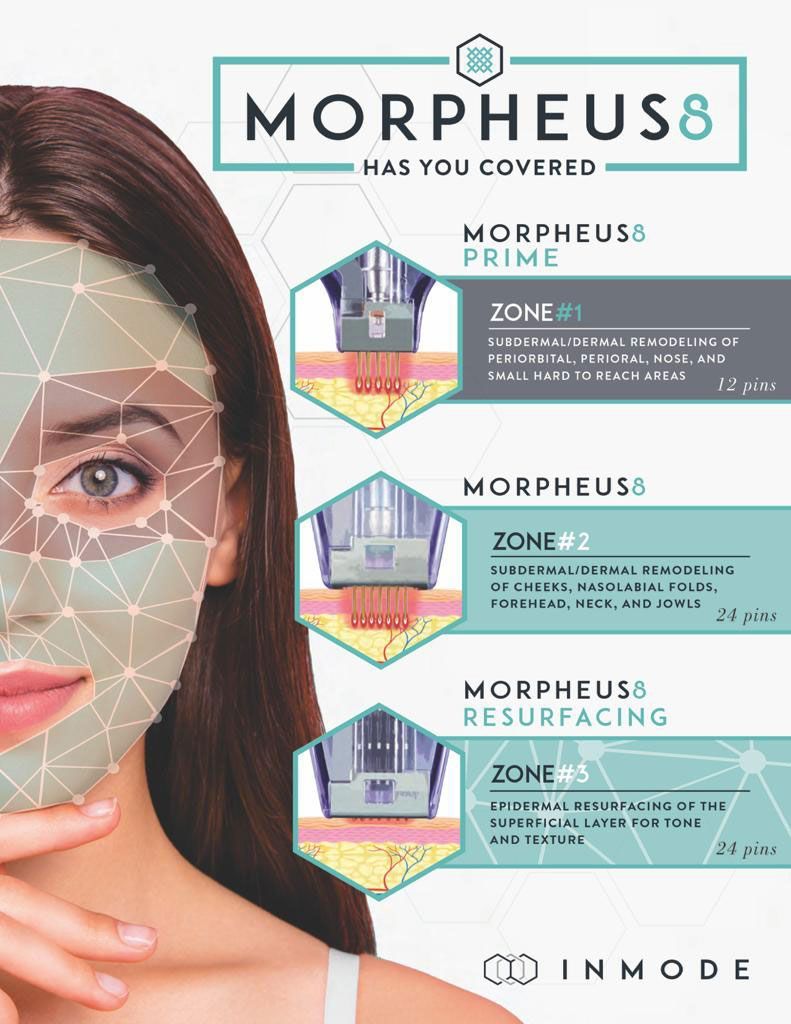 Morpheus8 from Williamson Cosmetic Center in Louisiana