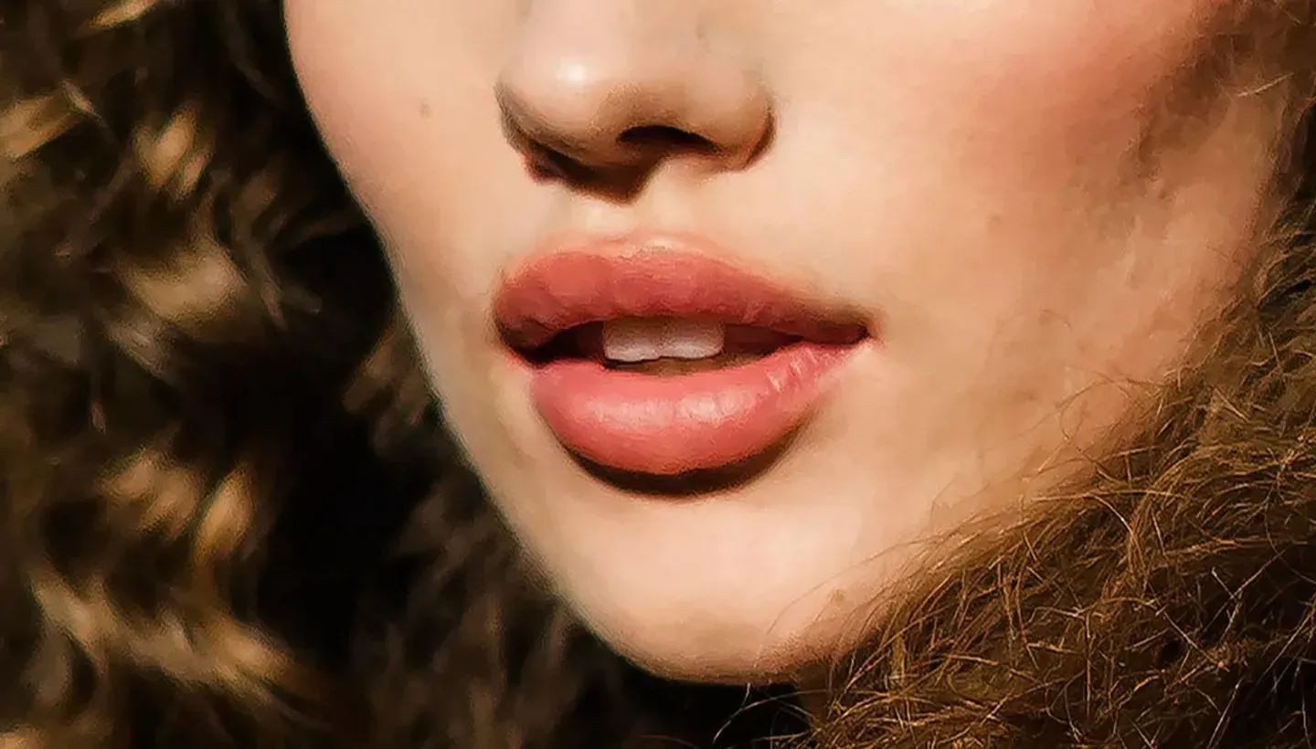 Lip Filler Trends: Why “Natural” Lips Are Taking Over - Williamson Cosmetic Center