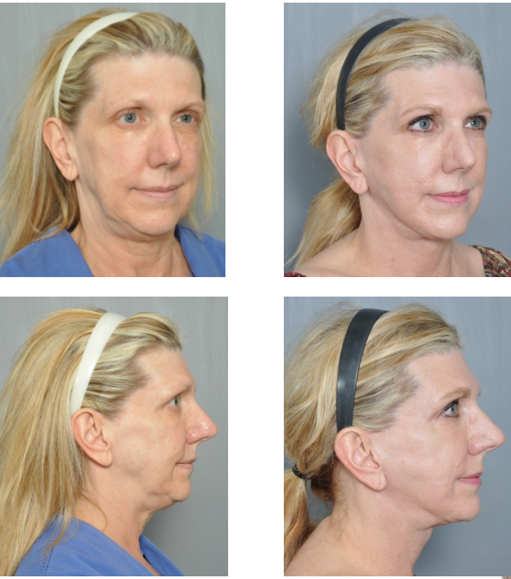 Dr. Jon Perenack - Williamson Cosmetic Center & Perenack Aesthetic Surgery