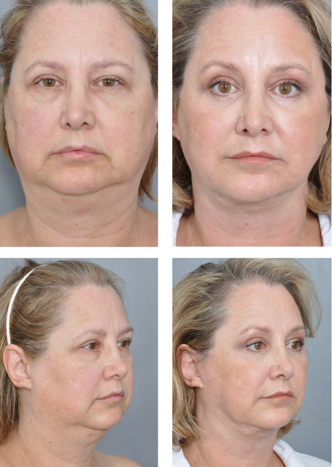 Dr. Jon Perenack - Williamson Cosmetic Center & Perenack Aesthetic Surgery