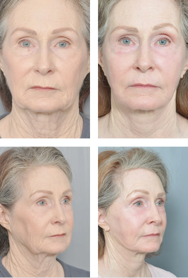 Dr. Jon Perenack - Williamson Cosmetic Center & Perenack Aesthetic Surgery