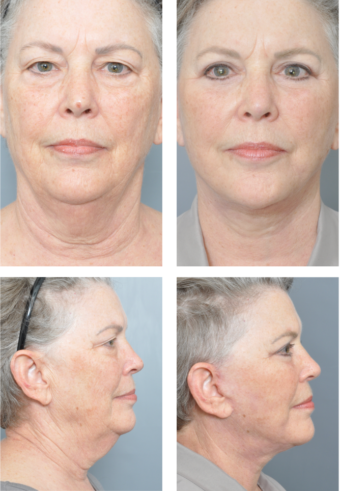 Dr. Jon Perenack - Williamson Cosmetic Center & Perenack Aesthetic Surgery