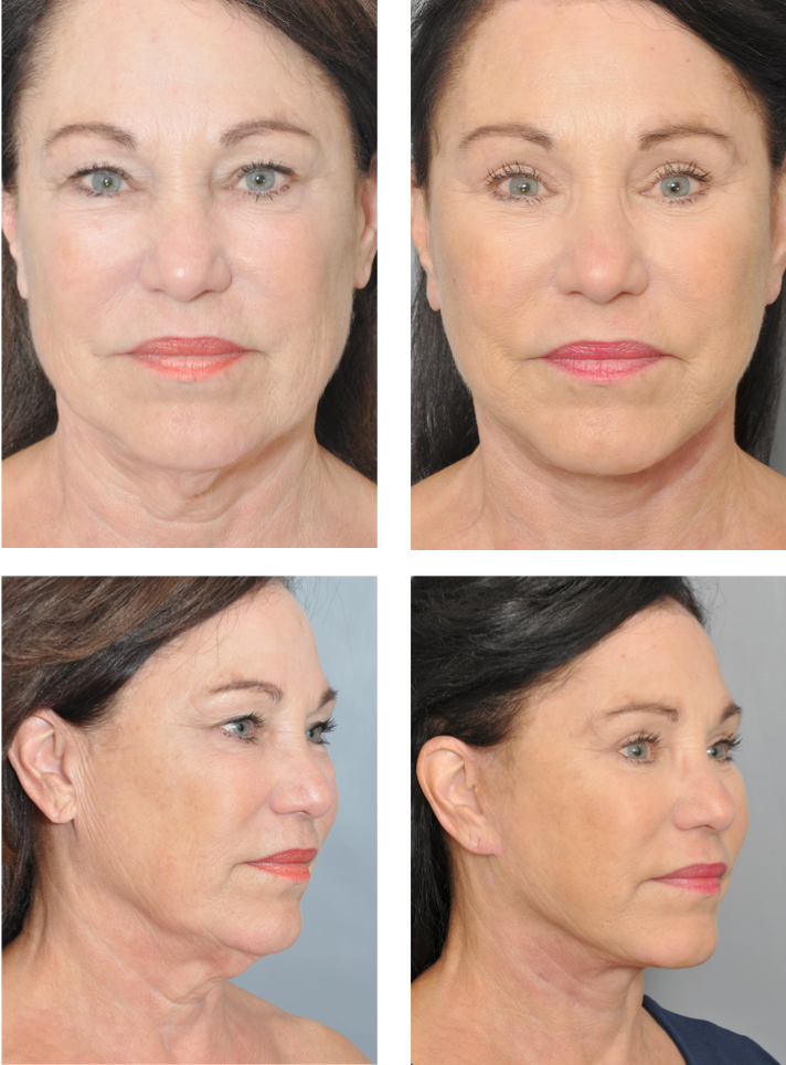 Dr. Jon Perenack - Williamson Cosmetic Center & Perenack Aesthetic Surgery