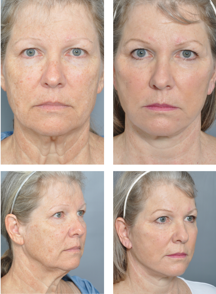 Dr. Jon Perenack - Williamson Cosmetic Center & Perenack Aesthetic Surgery