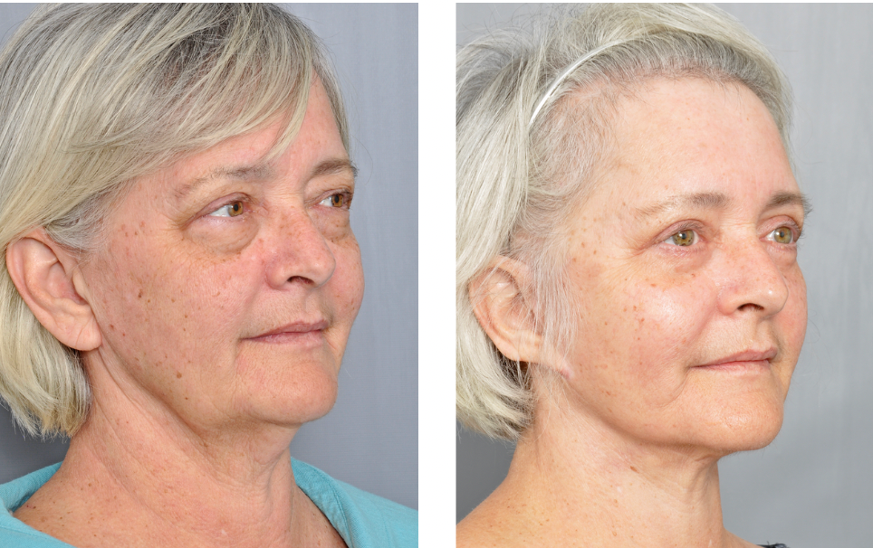 Dr. Jon Perenack - Williamson Cosmetic Center & Perenack Aesthetic Surgery