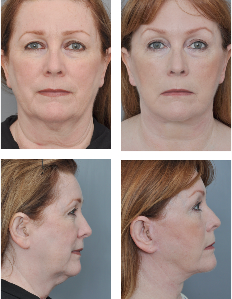 Dr. Jon Perenack - Williamson Cosmetic Center & Perenack Aesthetic Surgery
