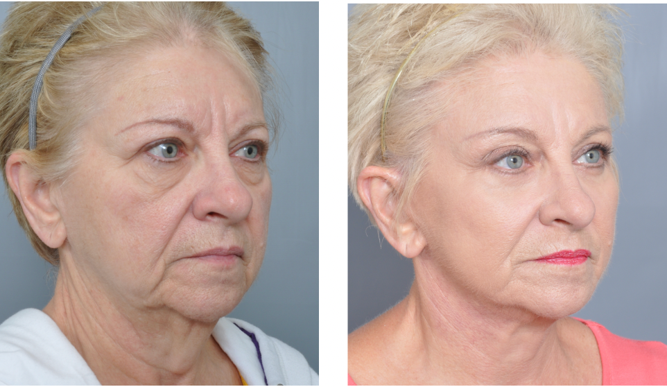 Dr. Jon Perenack - Williamson Cosmetic Center & Perenack Aesthetic Surgery