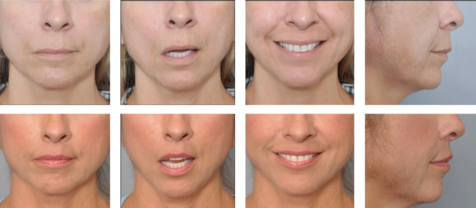 Close-up views of a person's mouth displaying various expressions and lip movements.