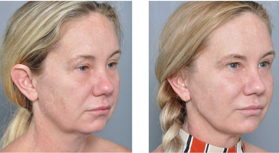Dr. Jon Perenack - Williamson Cosmetic Center & Perenack Aesthetic Surgery