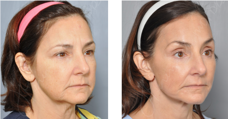 Dr. Jon Perenack - Williamson Cosmetic Center & Perenack Aesthetic Surgery
