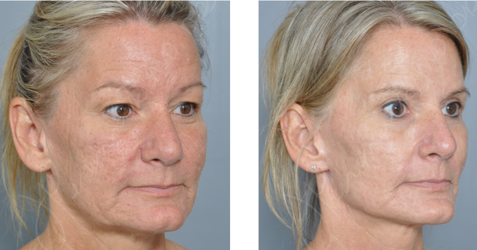 Dr. Jon Perenack - Williamson Cosmetic Center & Perenack Aesthetic Surgery