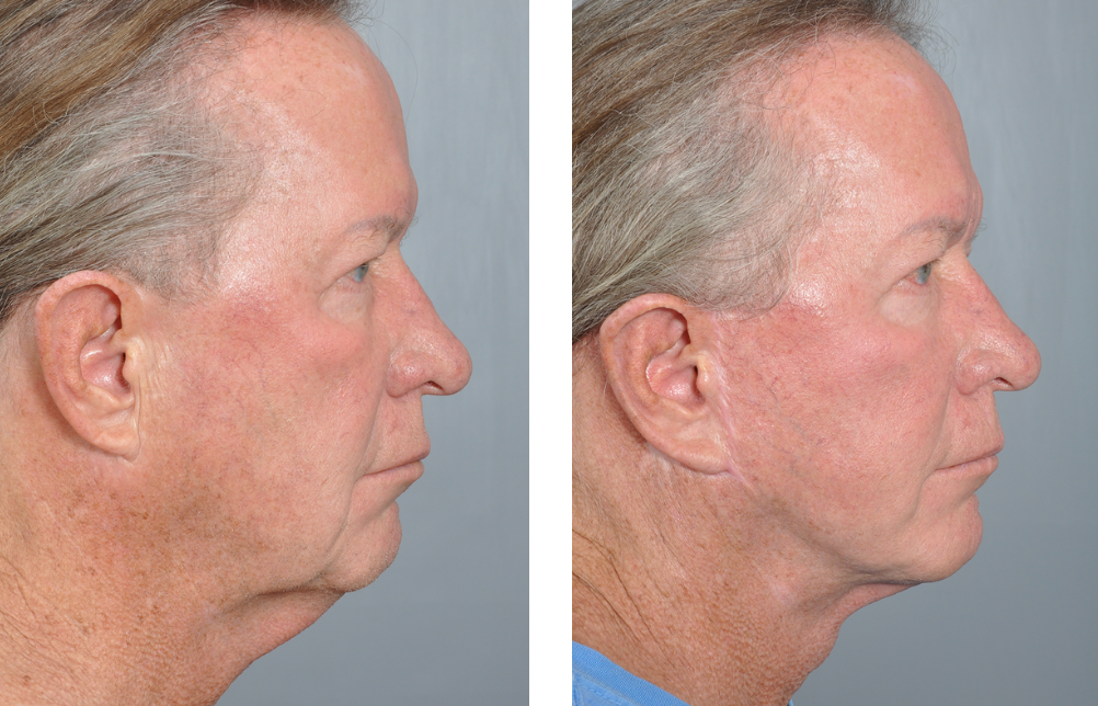 Dr. Jon Perenack - Williamson Cosmetic Center & Perenack Aesthetic Surgery
