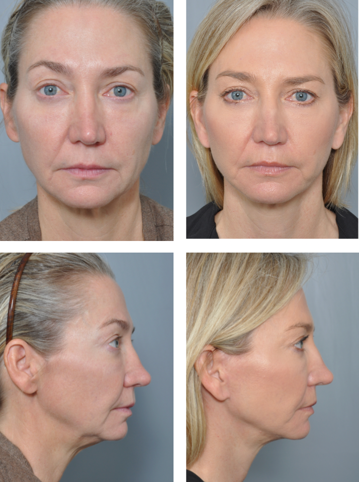 Dr. Jon Perenack - Williamson Cosmetic Center & Perenack Aesthetic Surgery