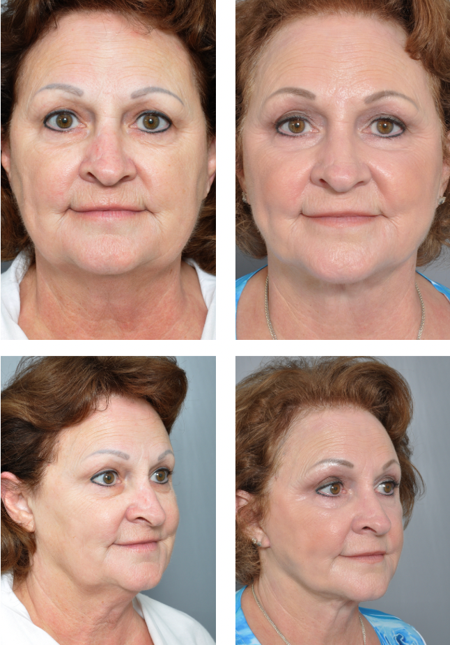 Dr. Jon Perenack - Williamson Cosmetic Center & Perenack Aesthetic Surgery