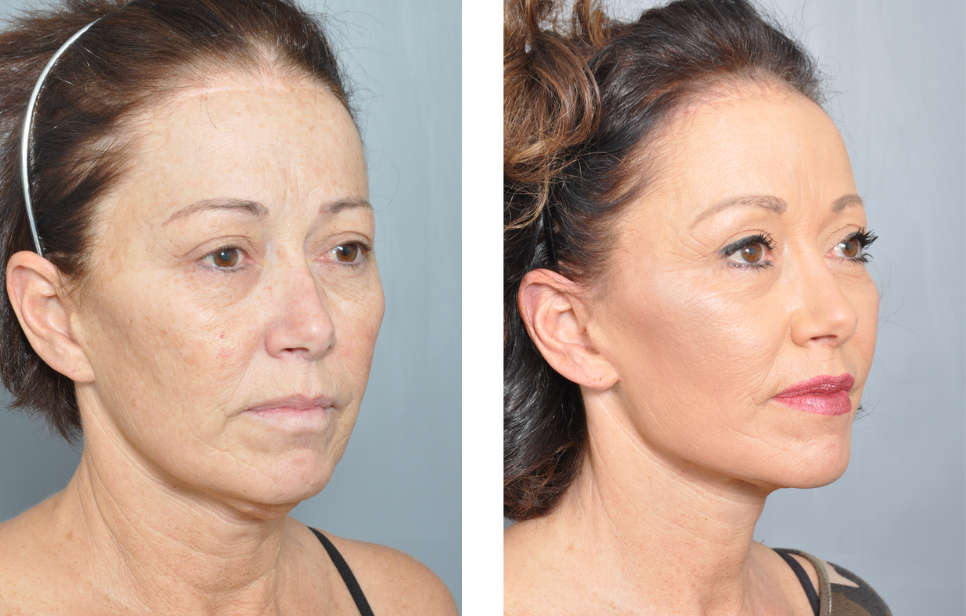 Dr. Jon Perenack - Williamson Cosmetic Center & Perenack Aesthetic Surgery