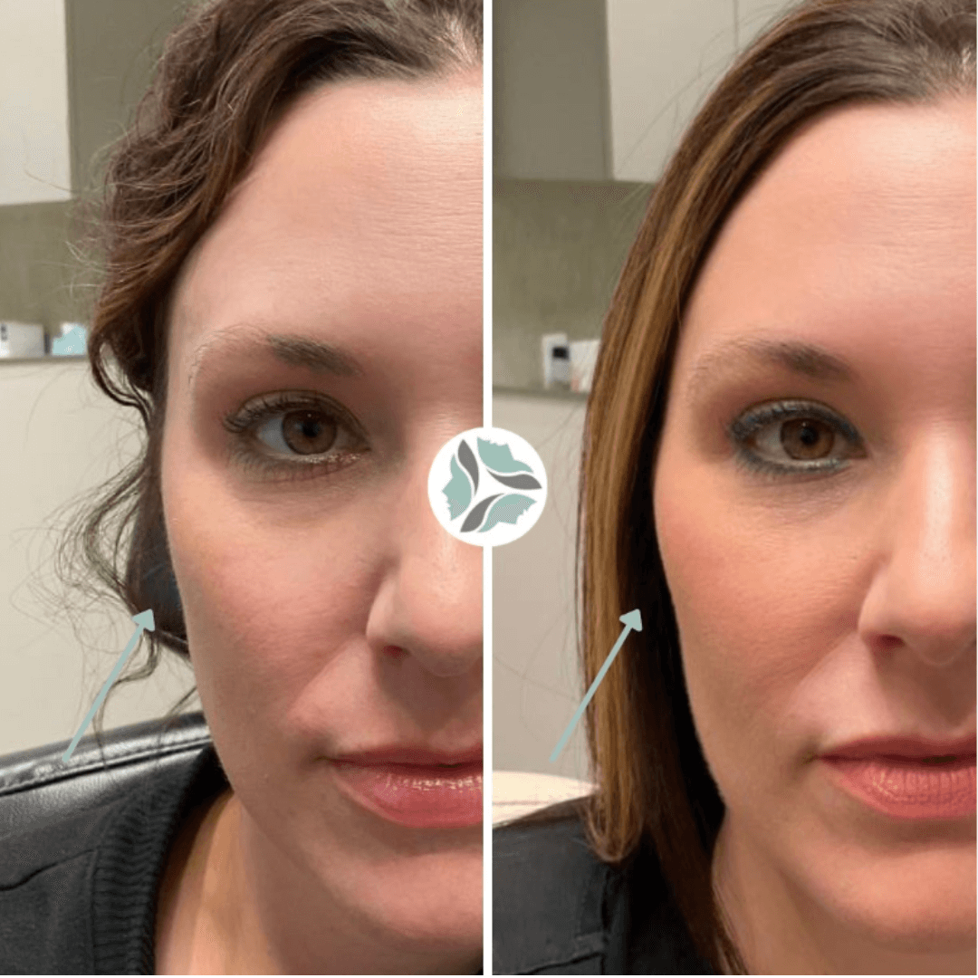 Split face comparison: woman with curly hair on left, straight hair on right; cheeks appear fuller on right side.