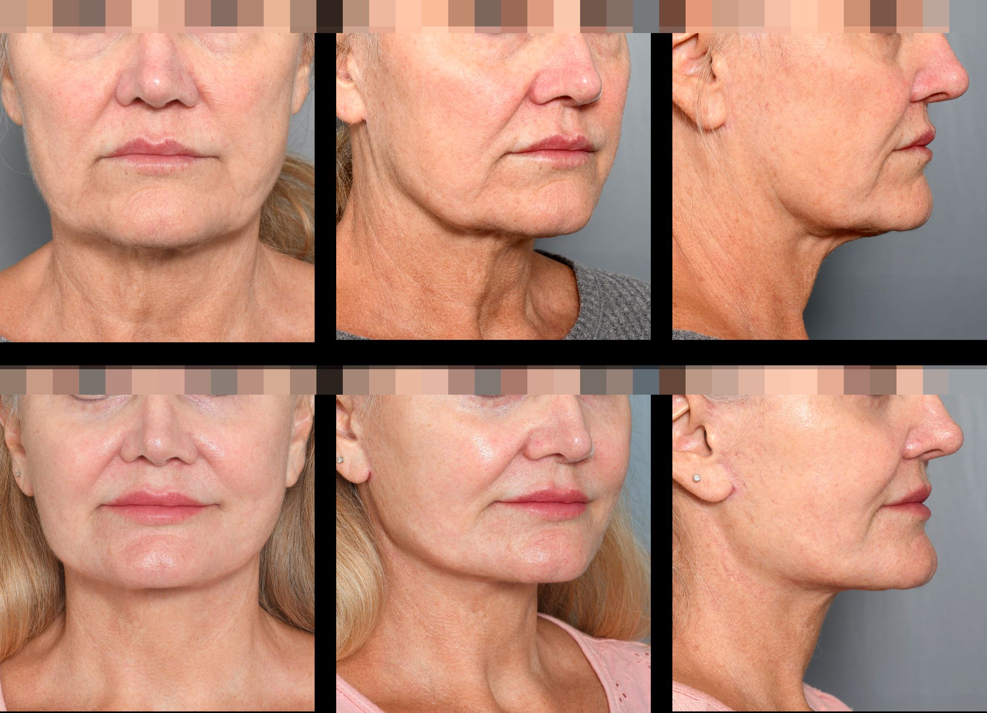 Dr. Jon Perenack - Williamson Cosmetic Center & Perenack Aesthetic Surgery