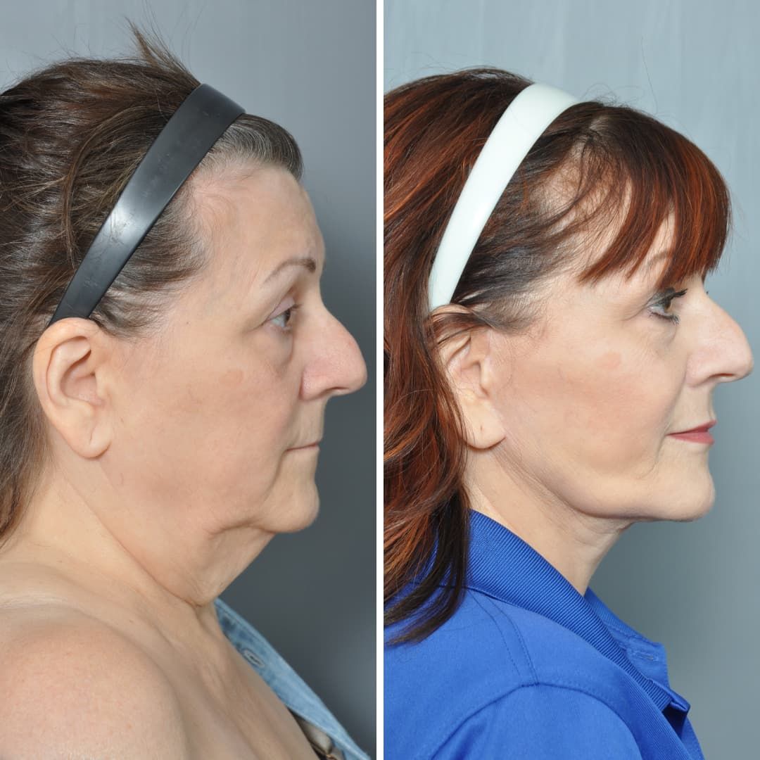 Dr. Jon Perenack - Williamson Cosmetic Center & Perenack Aesthetic Surgery