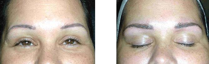 Two close-up photos of a person's eyes and eyebrows. The left eye is open, the right eye closed. Eyebrows are tattooed.