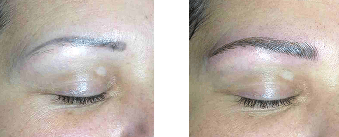 Before and after of a tattooed eyebrow. The left is light and sparse, and the right is darker and fuller.