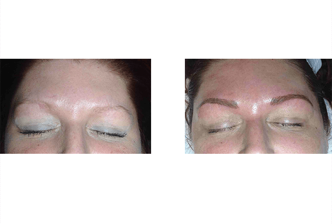 Before and after eyebrow microblading: pale brows enhanced to defined, filled brows.